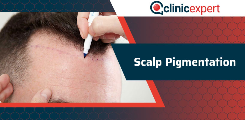 Scalp Pigmentation