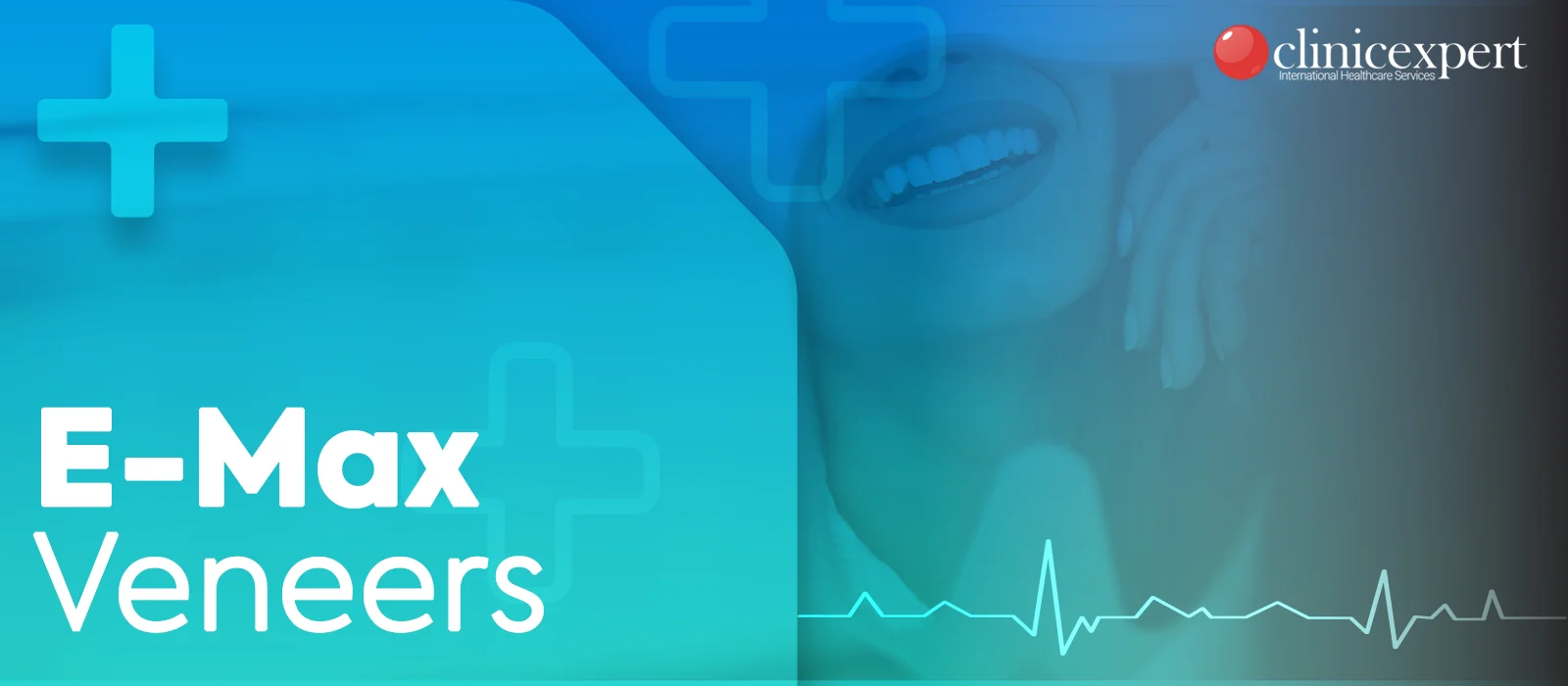 E-Max-Veneers
